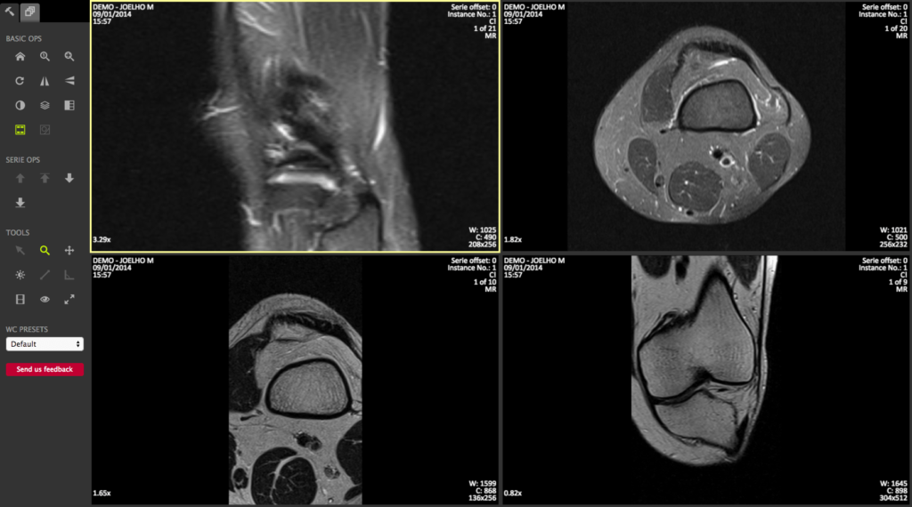 DICOM viewer PACS