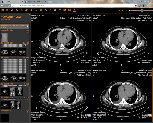 HTML5 DICOM viewer open source